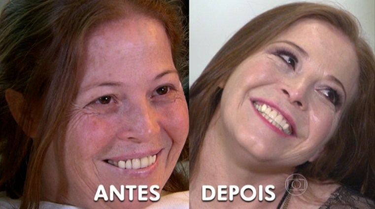 Mudança do sorriso