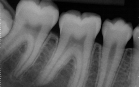 Radiografias digitais